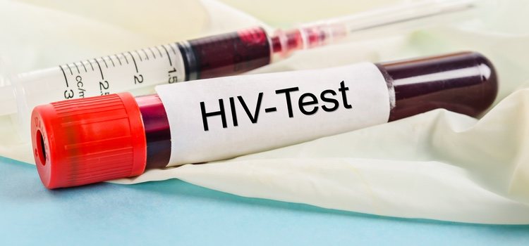 El VIH puede encontrarse en el líquido preseminal, por lo que se debe usar protección